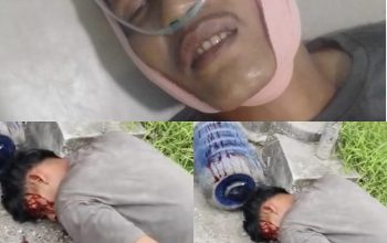 Pak Kapolsek Bukit Raya! Tolong Kedua Korban ini, Hampir Kehilangan Nyawa Ditabrak dan Dikeroyok OTK Pakai Linggis