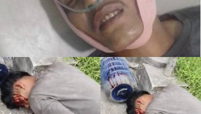 Pak Kapolsek Bukit Raya! Tolong Kedua Korban ini, Hampir Kehilangan Nyawa Ditabrak dan Dikeroyok OTK Pakai Linggis